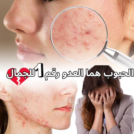 patch-anti-acne