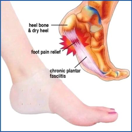 Protège talons en silicone كعب السيلكون لماشاكل القدمين