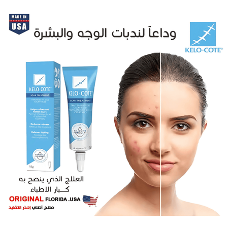 الاصلي الافضل لازالة جميع انواع الندبات السيكاتريس