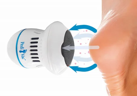 جهاز تقشير القدم الكهربائي