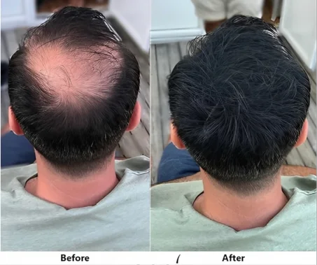 Toppik Hair  لملئ فراغات الشعر