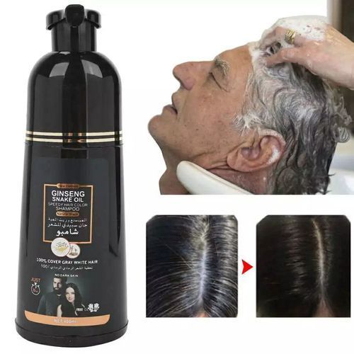stores/6404ead8cbf178fa236c63a4c4602ea5/products/4HPaUColwYleiPBIDVSRyYZ9O81IhvQViJTthe2I.jpeg