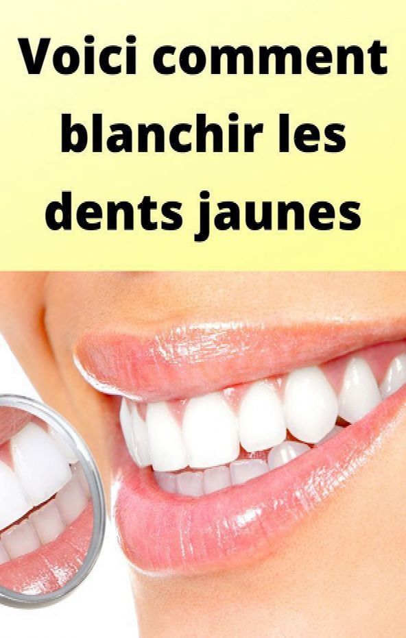 BLANCHISSEUR DE DENT