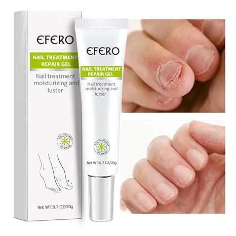 Gel Efero  لعلاج فطريات الأظافر