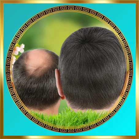 تساقط الشعر