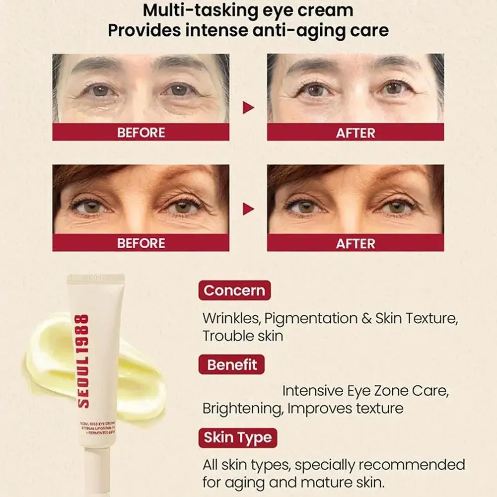Seoul 1988 Eye Cream – Smooth Wrinkles & Brighten Dark Circles Fast