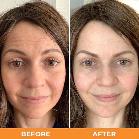 🌟 Nano Collagen Face Lift Kit – Smooth, Tighten & Glow!