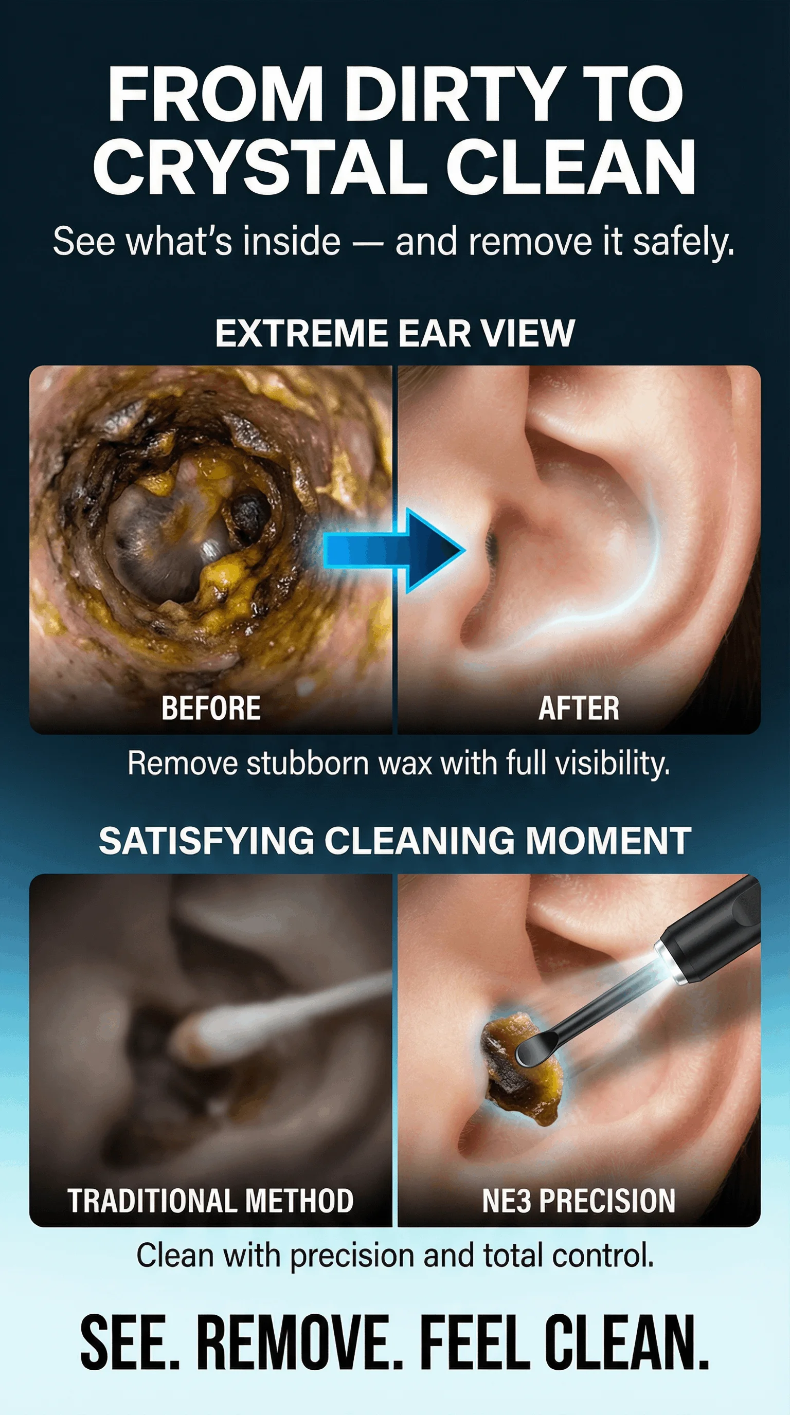 Stop Cleaning Blindly! Smart Ear Cleaner with Camera