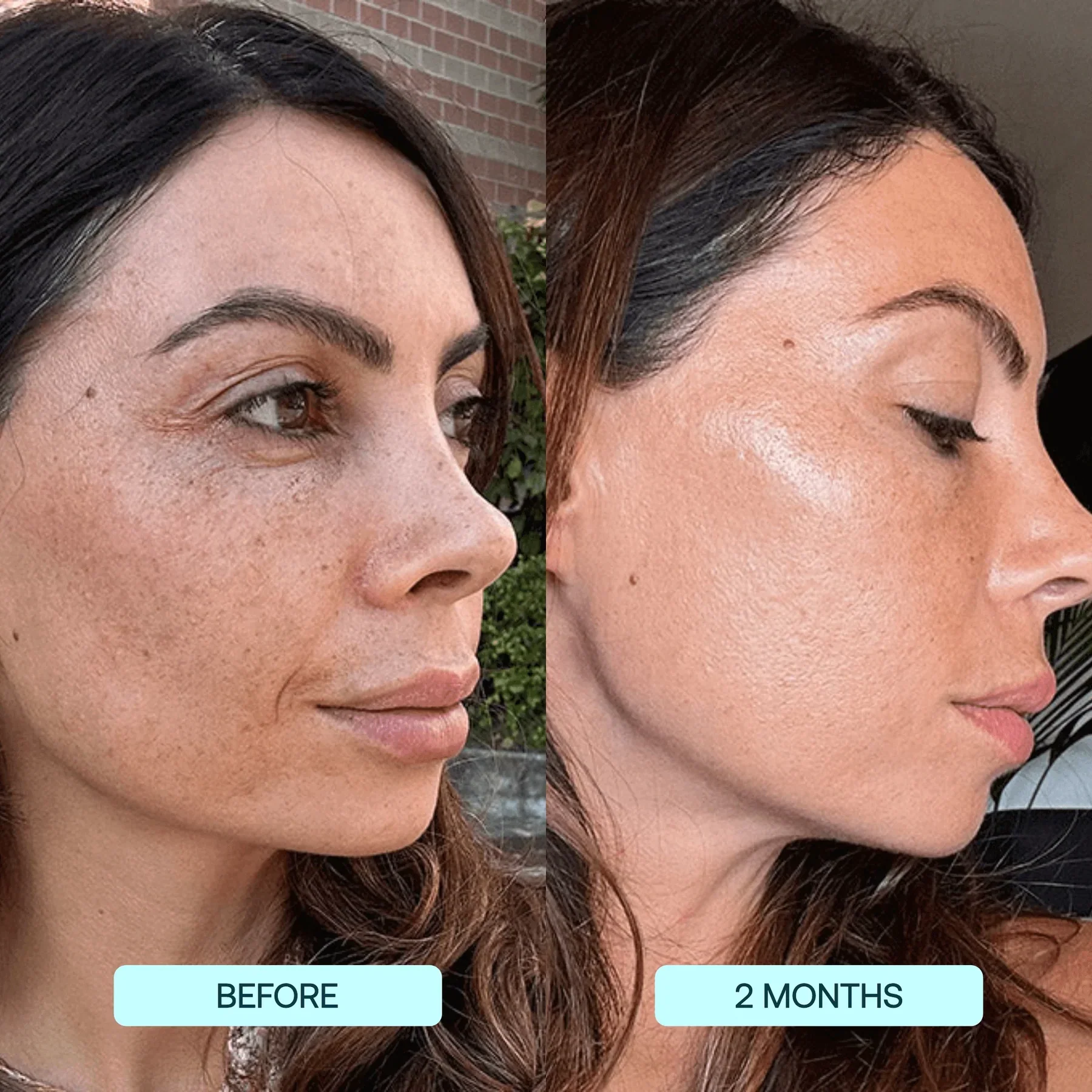 🌟 Nano Collagen Face Lift Kit – Smooth, Tighten & Glow!