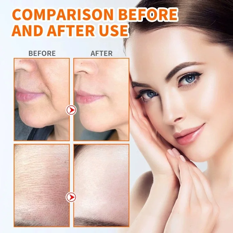 🌟 Nano Collagen Face Lift Kit – Smooth, Tighten & Glow!