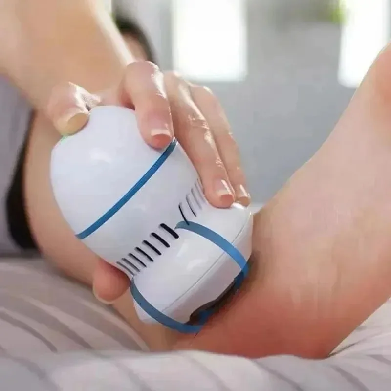 Rechargeable Electric Foot Callus Remover – Remove Cracked Heels & Dead Skin Fast