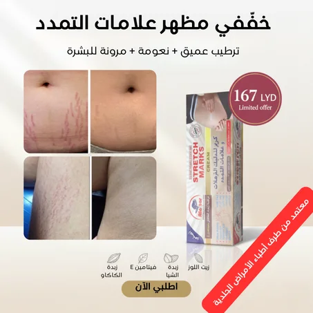 كريم إزالة علامات التمدد