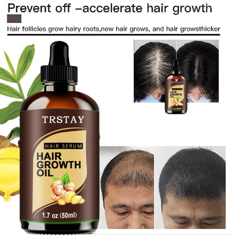 زيت قوي لإنبات و منع تساقط الشعر