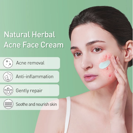 كريم وجه لإزالة الندوب و علاج حب الشباب