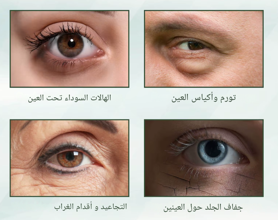 تخلصي من التجاعيد والهالات السوداء في أسابيع!