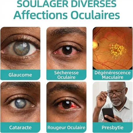 Soigner tes yeux sans produit chimique en 21 jours seulement