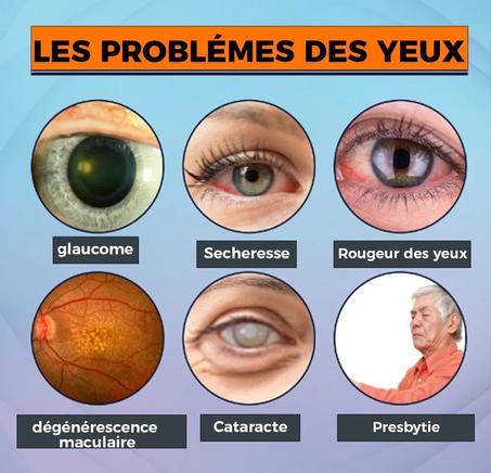 Repair Eye – Solution Naturelle pour Cataracte, Vision Floue et Glaucome