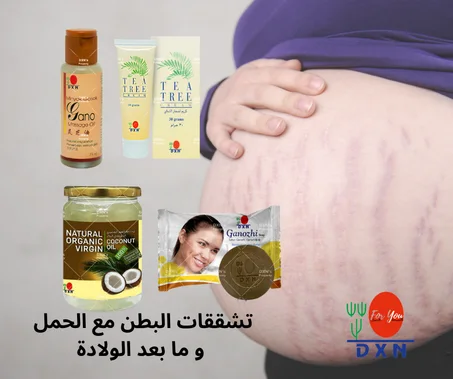 تشققات البطن مع الحمل  و ما بعد الولادة