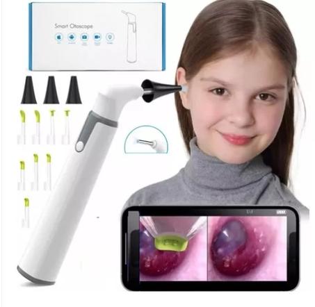 Otoscope Otoscope smart led