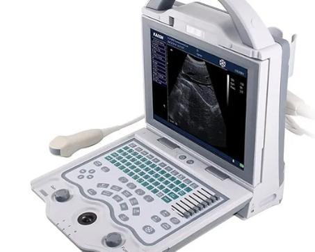 échographe portable KX5600