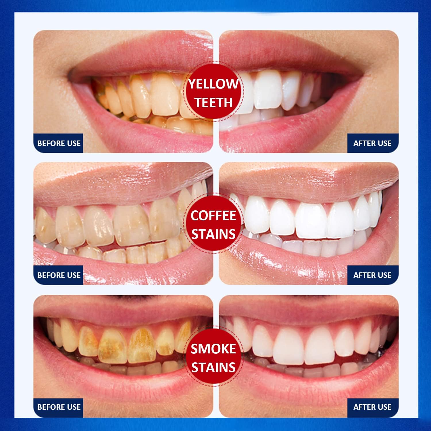 Teeth Whitening Strips