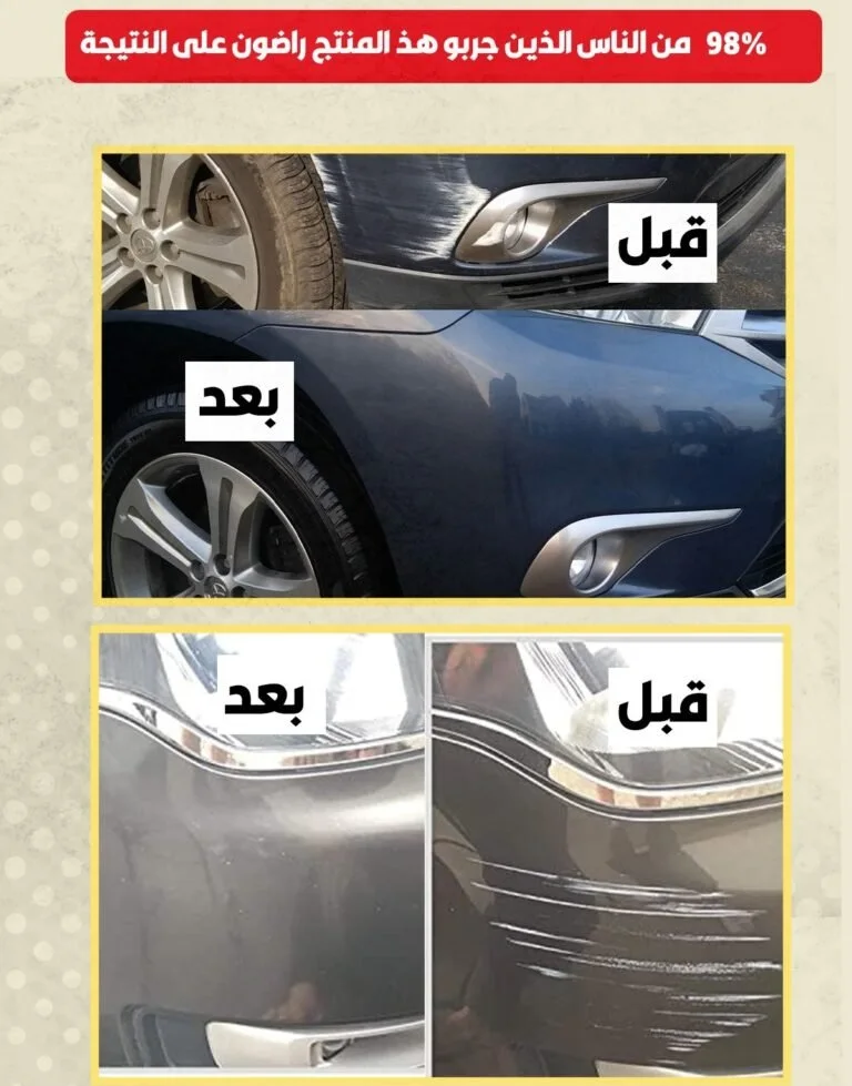مزيل الخدوش Winner