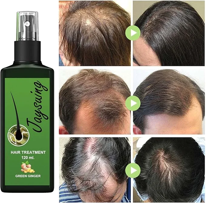 بخاخ الزنجبيل لعلاج تساقط الشعر