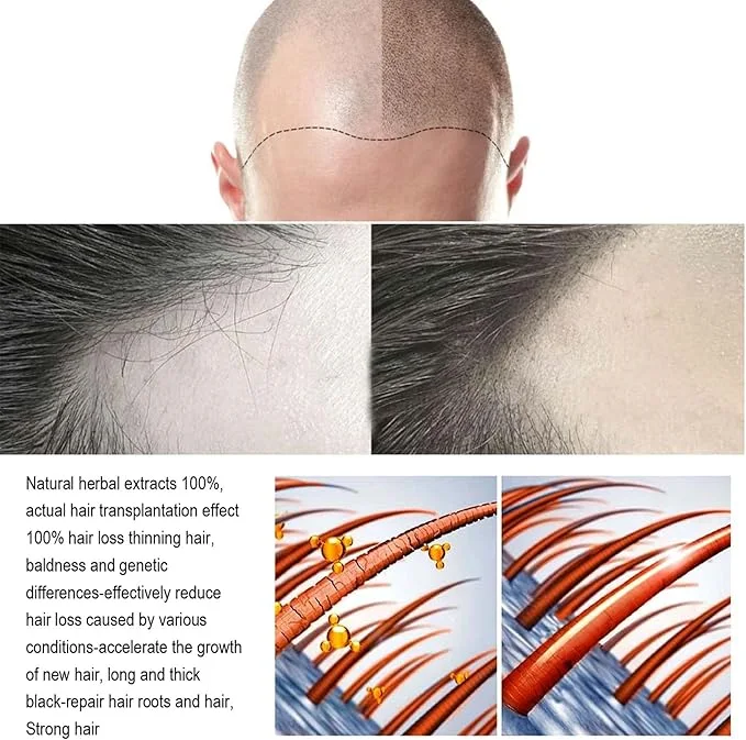 بخاخ الزنجبيل لعلاج تساقط الشعر