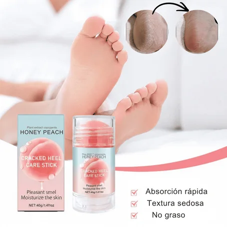La crema mágica para tratar los talones agrietados.