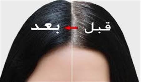 شامبو الشعر ضد الشيب الطبيعي