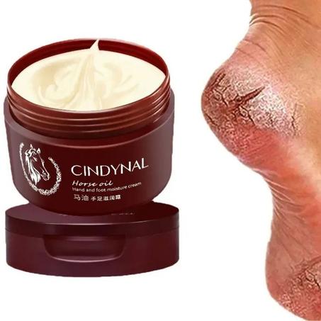 Cindynal: Crème pour les pieds réparatrice antifongique Crème pour les pieds réparatrice pour la peau morte Peeling Hydratant Exfoliation Soin des pieds Crème réparatrice pour talons crevassé