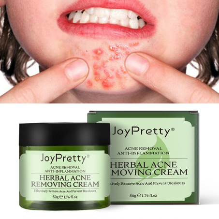 Face Acne Cream