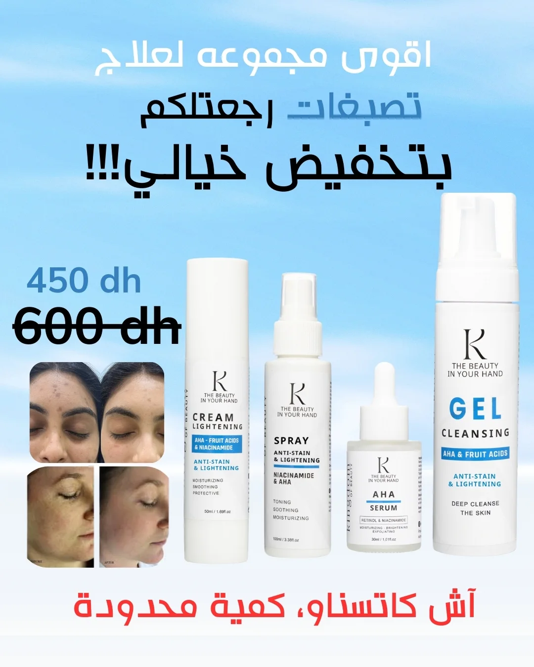 التصبغ والكلف