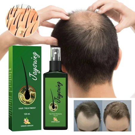 زيت الزنجبيل الأخضر لعلاج تساقط الشعر واستعادة كثافت
