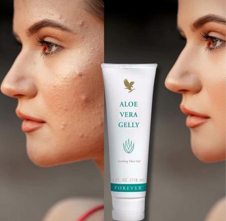 Aloe Vera Gelly – العلاج الطبيعي لبشرتك