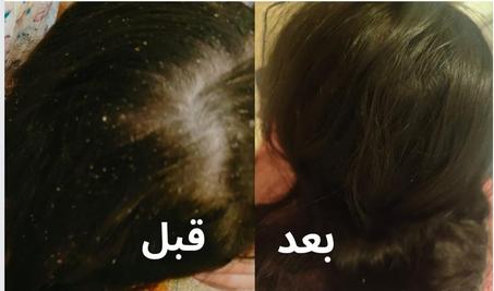 شامبو فوريفر Aloe-Jojoba اكتشف العناية الطبيعية لي تستحقها شعرك