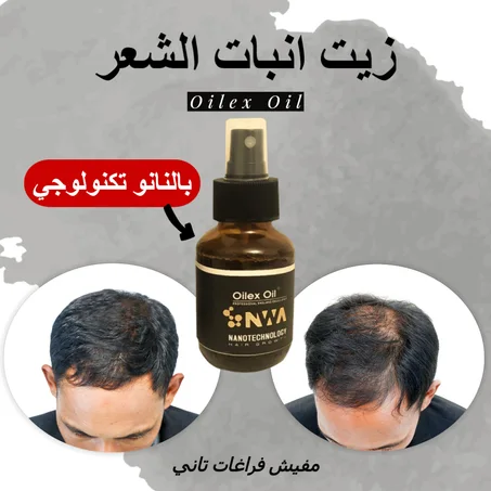 زيت لانبات الشعر والحمايه من الصلع بخصيه النانو تكنولوجي