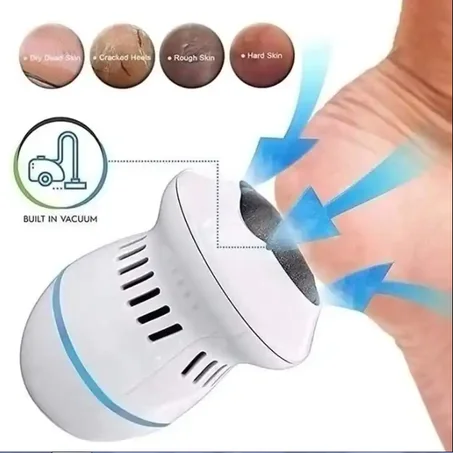 Electric feet callus removers