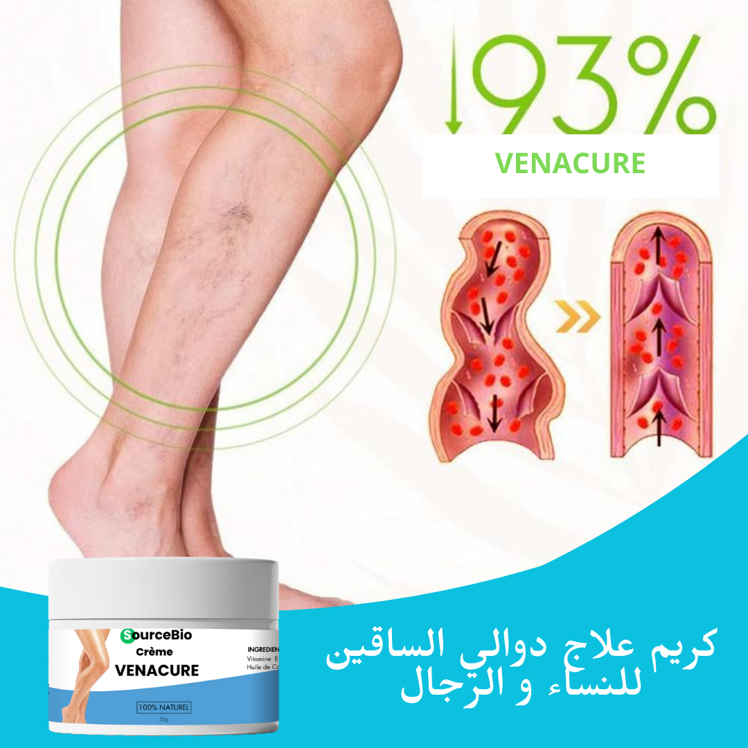 كريم الدوالي الساقين VENACURE