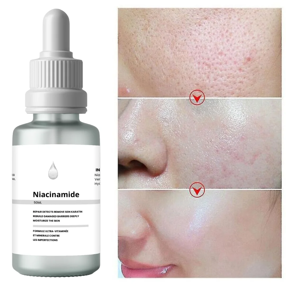 سيروم النياسيناميد Niacinamide 50 ml