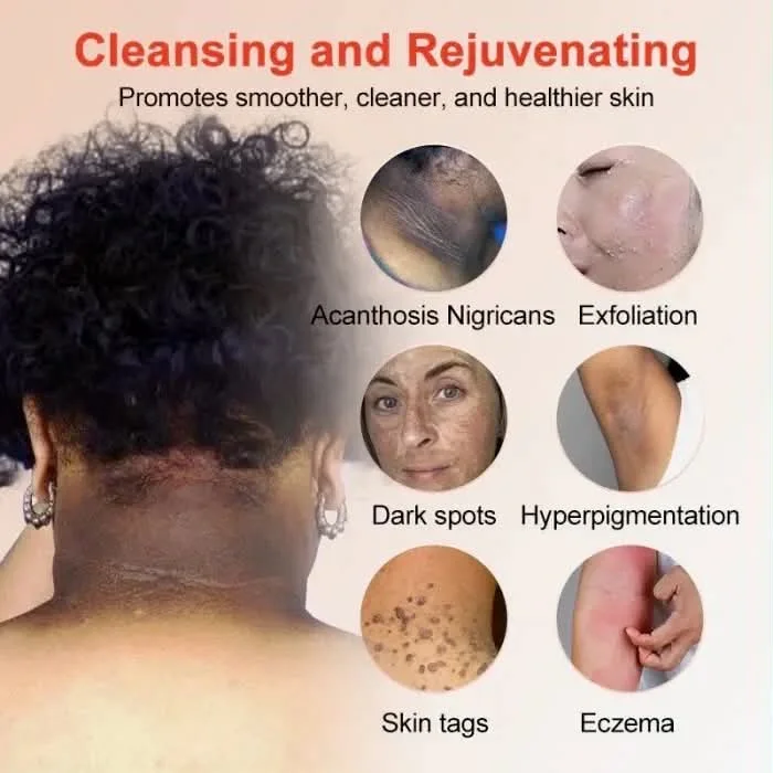 Orange enzymes exfoliating brightening gel