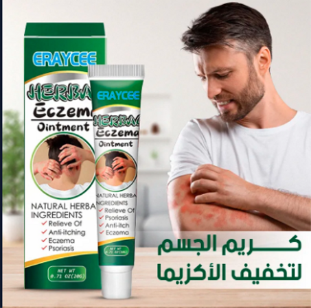 مرهم عشبي للأكزيما