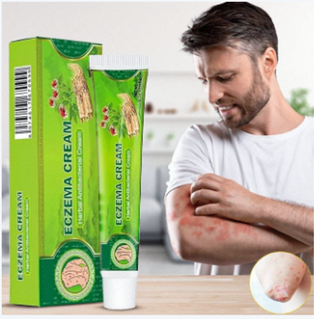 مرهم عشبي للأكزيما