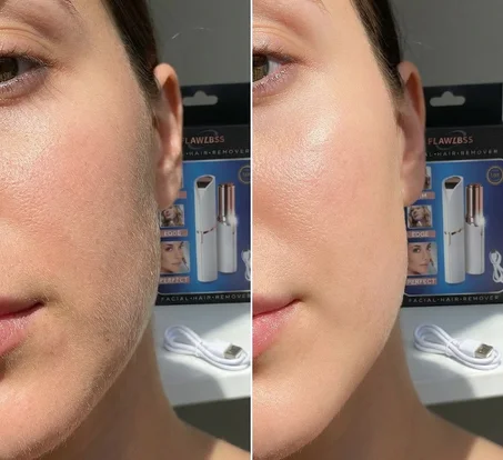 مزيل شعر الوجه المثالي