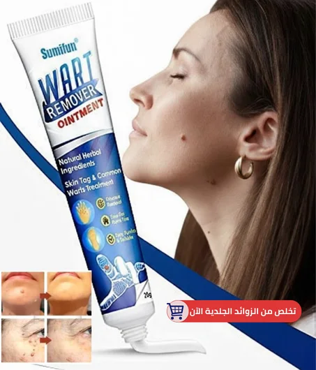 تخلص من الزوائد اللحمية والثآليل المزعجة نهائيا