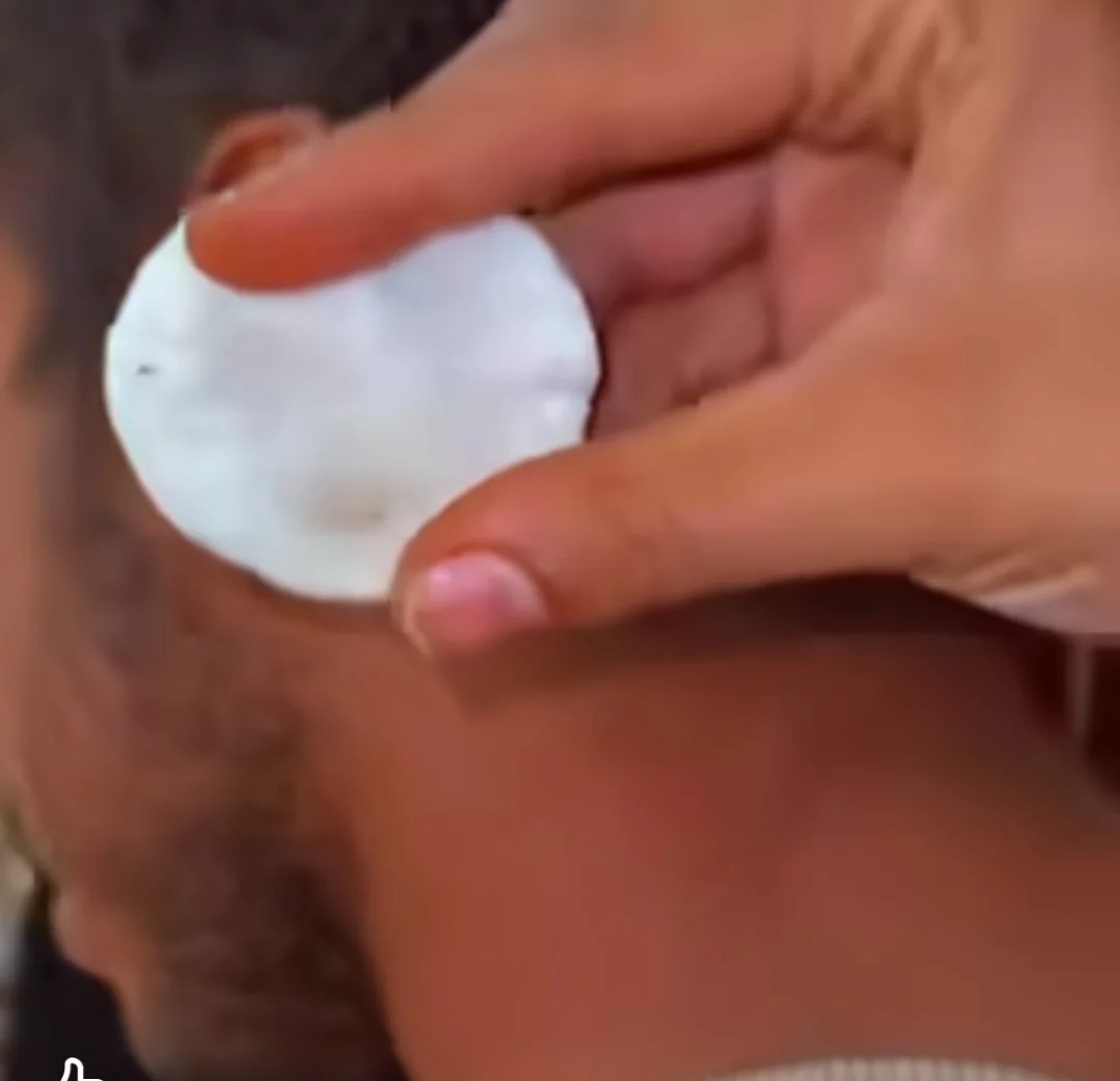 زيت تصحيح البقع الداكنة