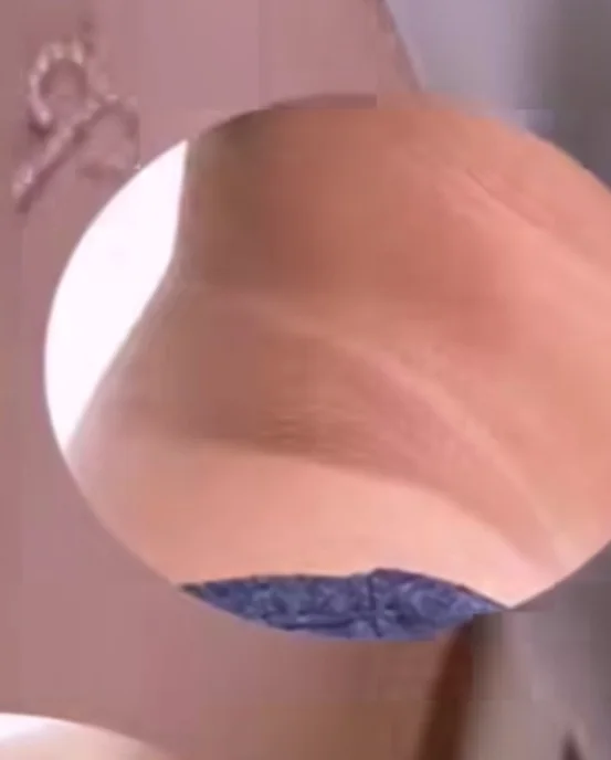 Dark Spot Removal Cream