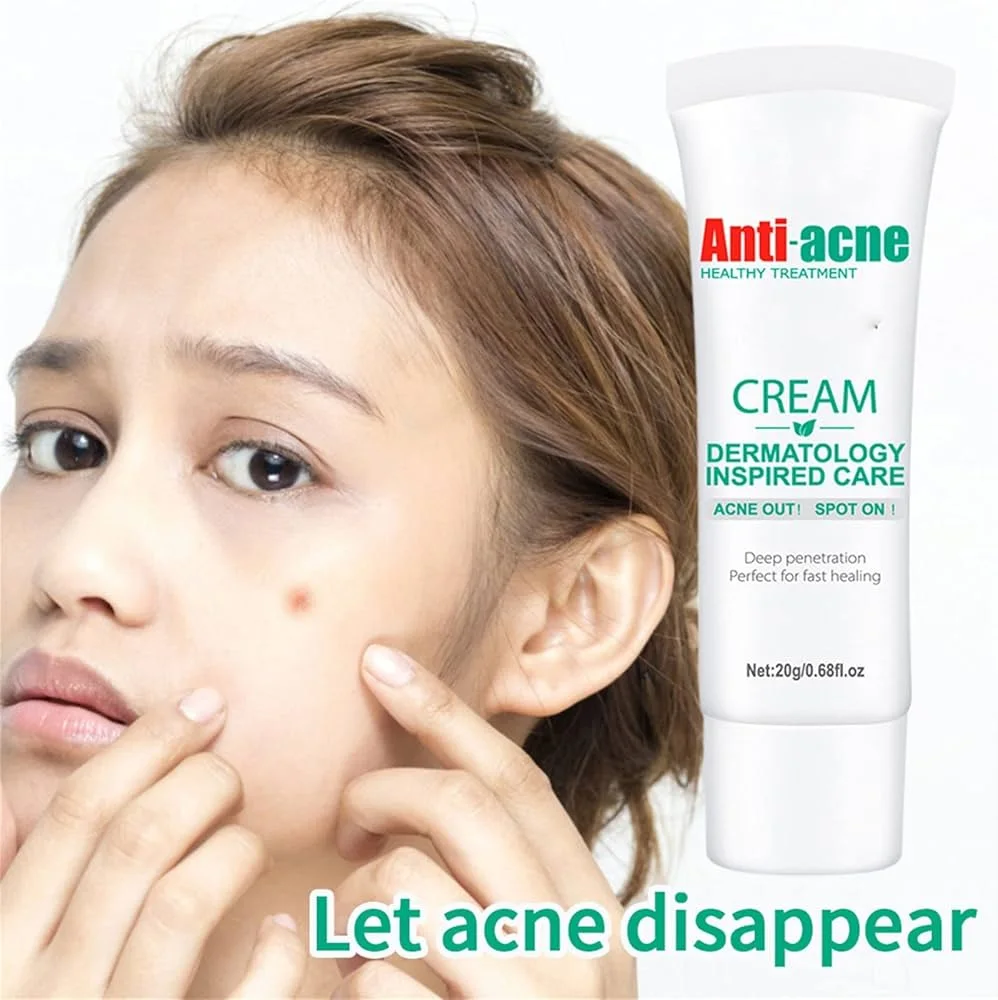 Crème Anti-acnés, élimine les boutons, les comédons , les peaux grasses et l'aspect huilé du visagela , Crème Anti-acné de la marque Aichun Beauty, un soin visage présenté en tube de 20 g. FC