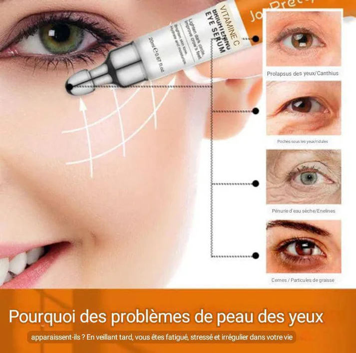 JoyPretty Sérum Éclat Yeux Vitamine C 20ml, Anti-Cernes, Anti-Poches, Anti-Rides, Pour un Regard Plus Jeune, Beau et Rayonnant