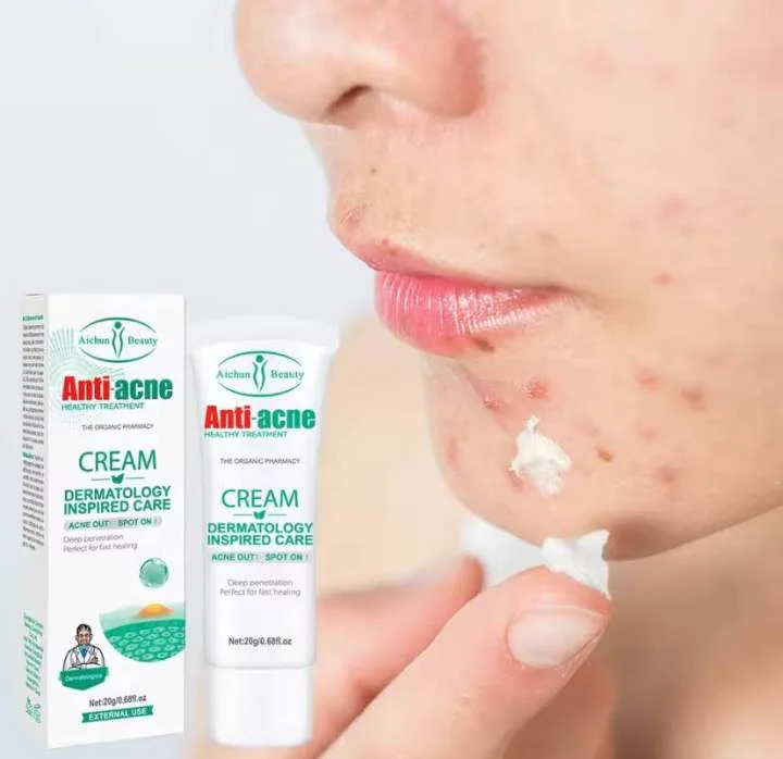 Crème Anti-acnés, élimine les boutons, les comédons , les peaux grasses et l'aspect huilé du visagela , Crème Anti-acné de la marque Aichun Beauty, un soin visage présenté en tube de 20 g. FC